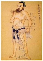 acupuncture-litographie-1.jpg